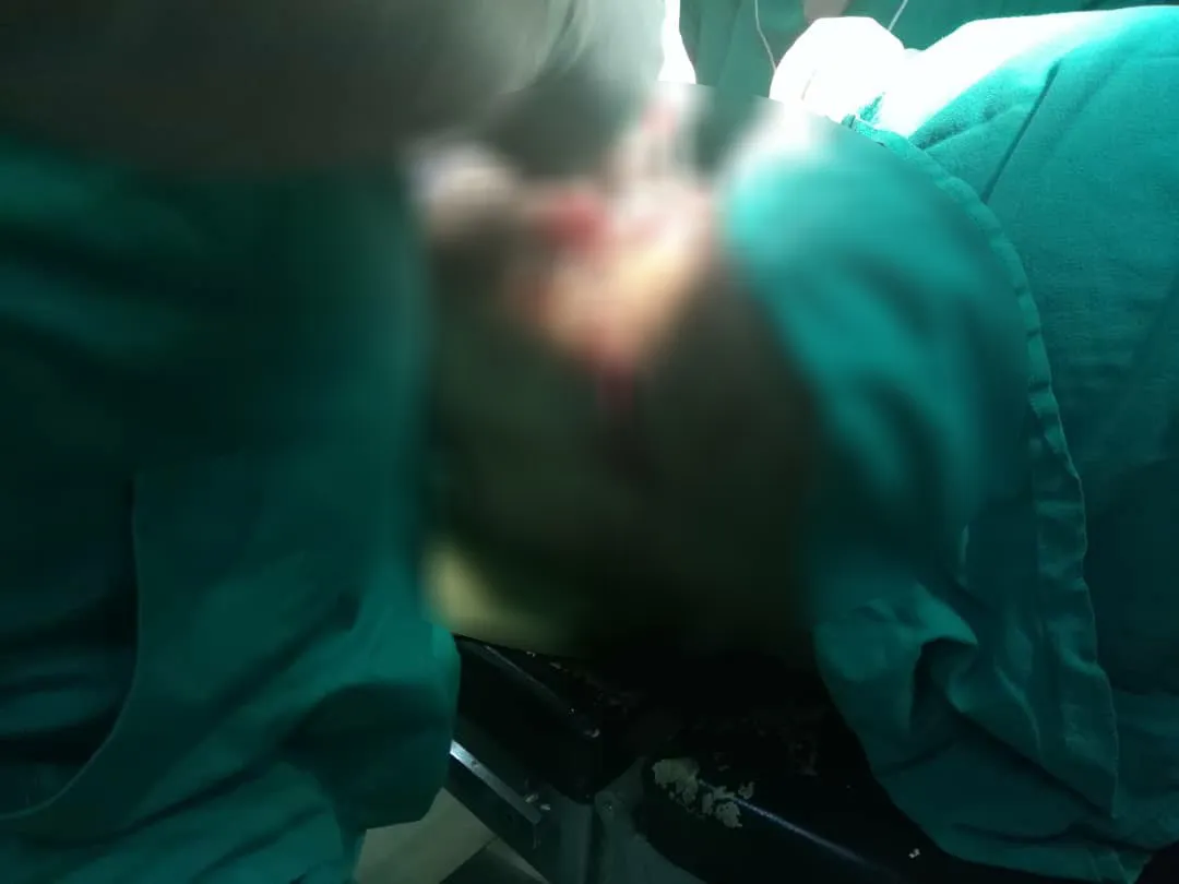 Artêşa Tirk li ser sînorê Dêrikê du cotkar birîndar kirin