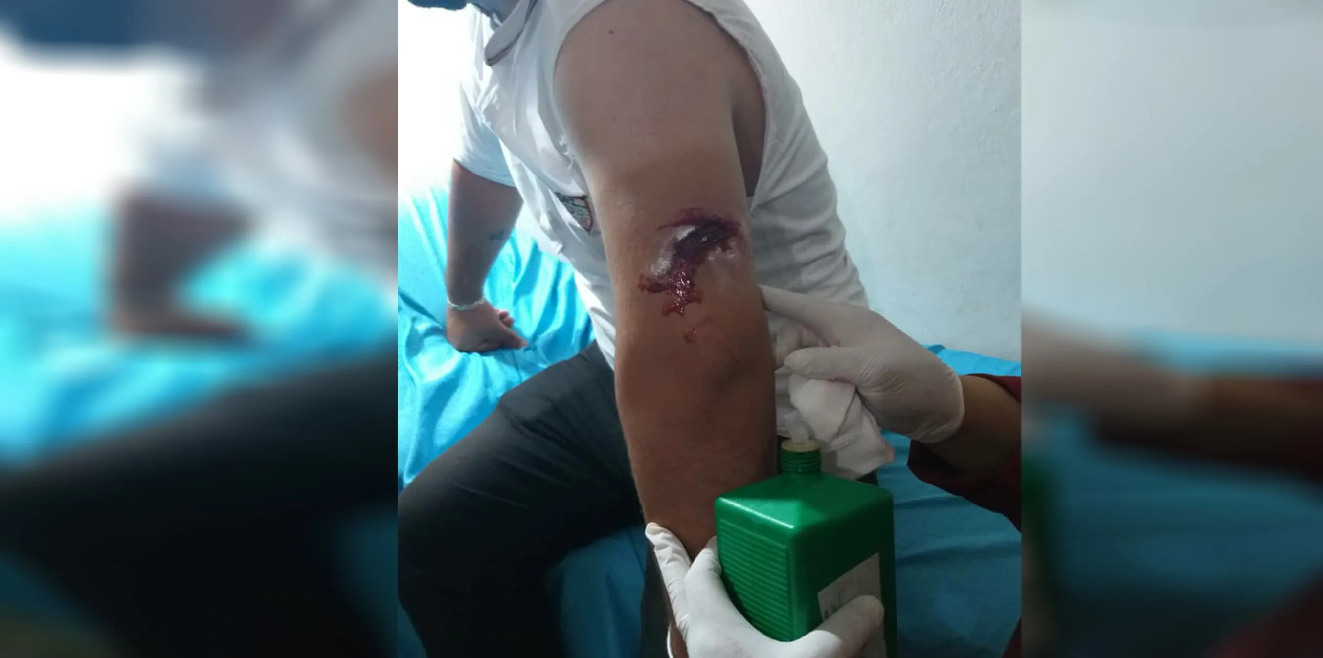 Di topbarana li ser Şêrawayê de sivîlek birîndar bû