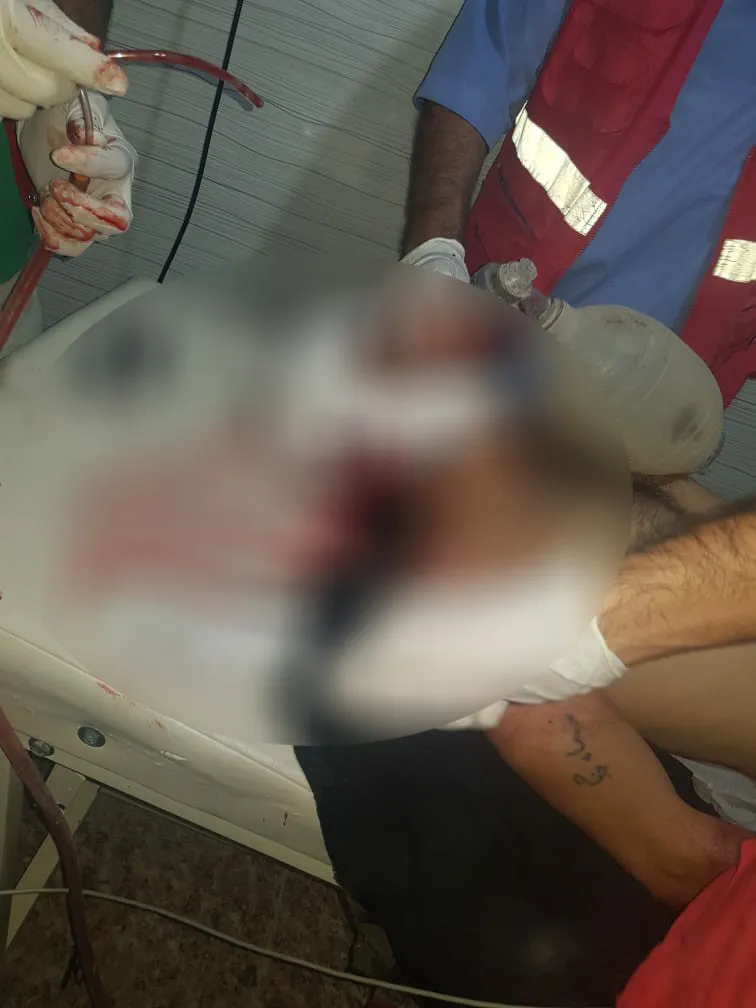 Li kampa Holê çeteyên DAIŞ`ê ciwanek kuştin