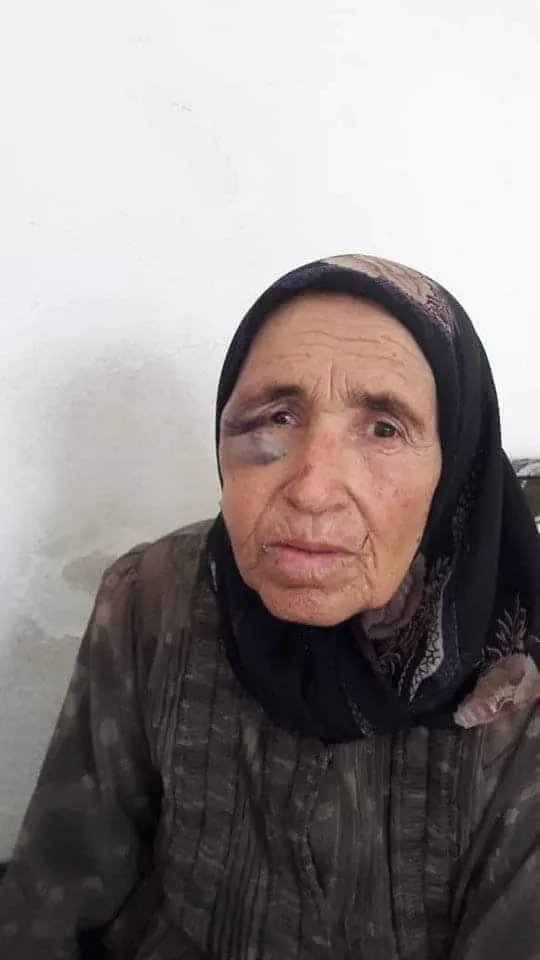 Li Efrînê pîrejinekê ji ber îşkenceyên çeteyan jiyana xwe ji dest da
