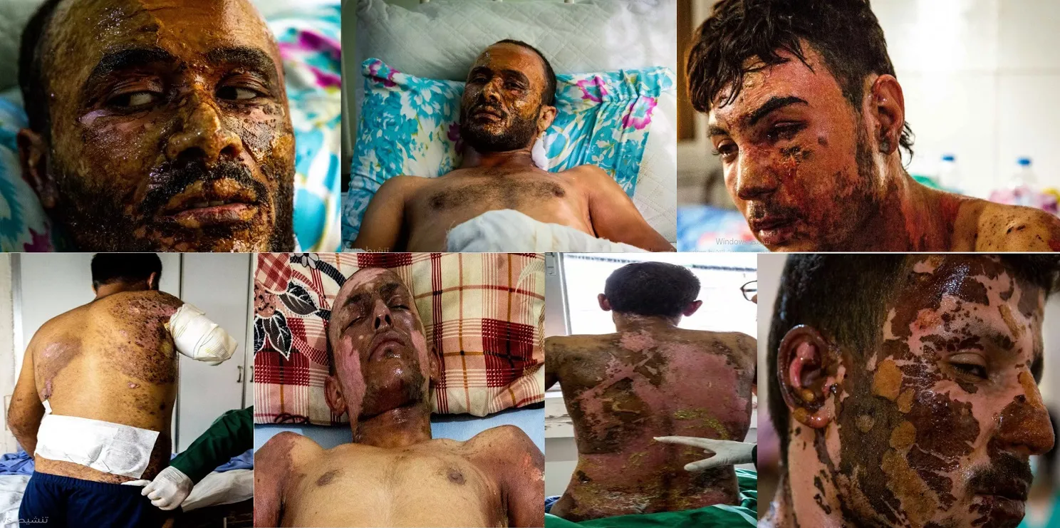 Newsweek bi wêne û belgeyan bikaranîna Tirkiyê ya çekên qedexekirî li Bakur û Rojihlatê Sûriyê, eşkere kir
