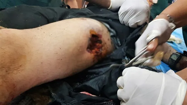 Navçeya Zirganê hat bombebarankirin, 1 şehîd û 3 birîndar hene