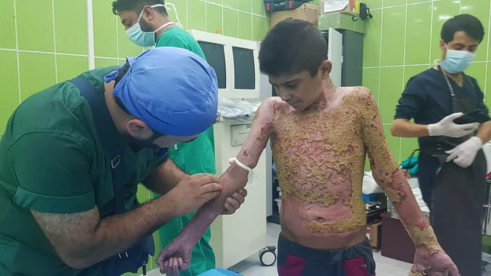 Li Serêkaniyê 8 sivîl di nav de zarok birîndar bûn