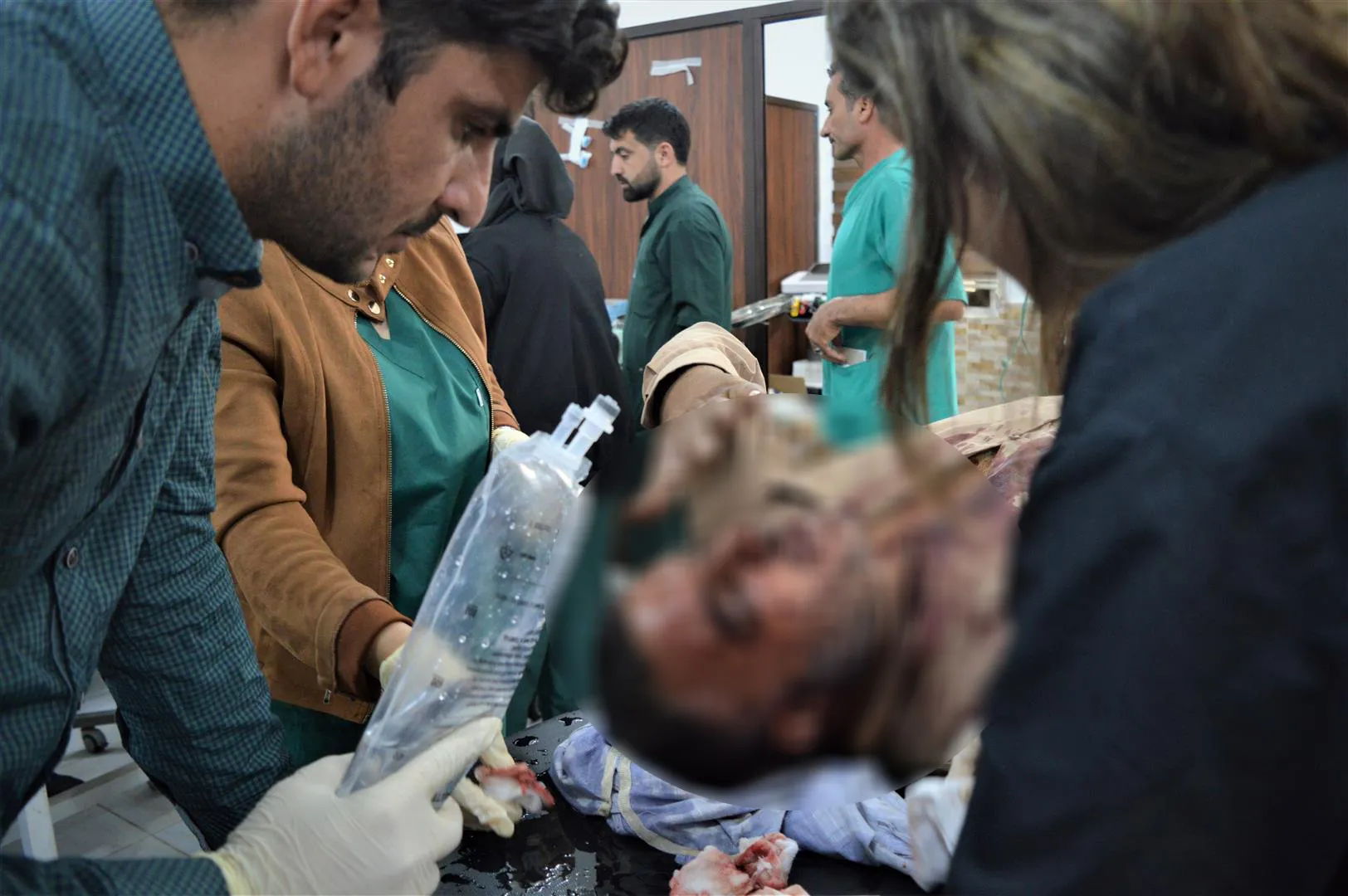 Çeteyên Tirk li Serêkaniyê du sivîl birîndar kirin-HATE NÛKIRIN  
