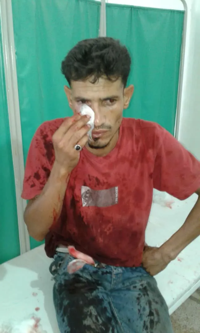 Li Şedadê Teqîn:Sivîlên birîndar hene