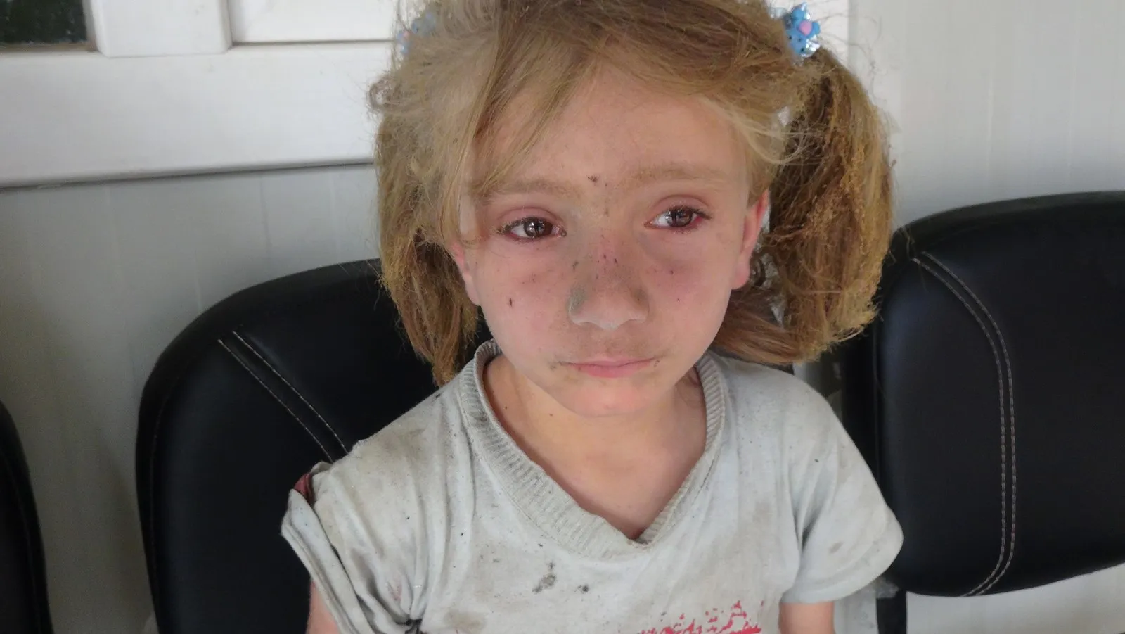 Di encama hedefgirtina gundê Şêx Îsa li Şehbayê 6 sivîl birîndar bûn