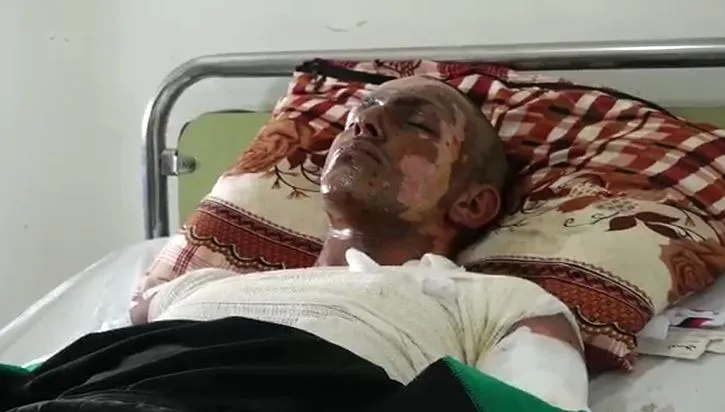 Birîndarên li Hesekê: Dewleta Tirk bi fosforê êrîşî me kir