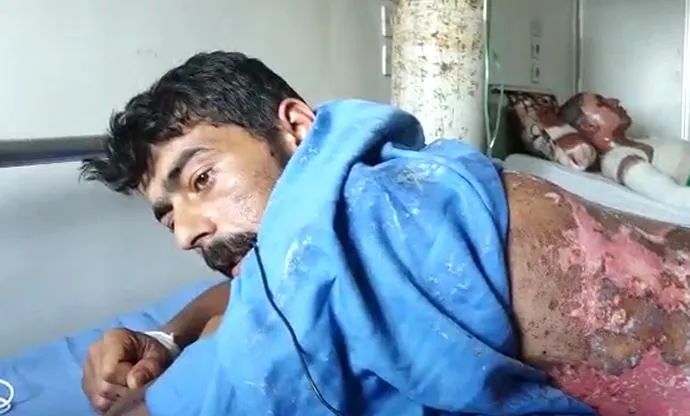 Birîndarên li Hesekê: Dewleta Tirk bi fosforê êrîşî me kir