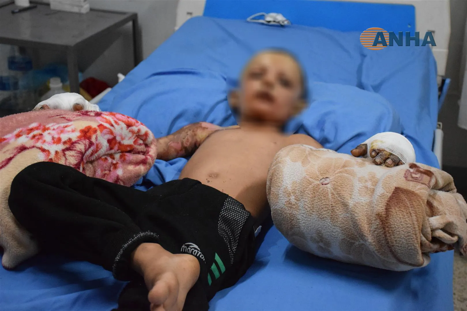 Bijîşkekî Nexweşxaneya Hesekê texmîn dike ku artêşa dagirker çekên qedexekirî bikar aniye