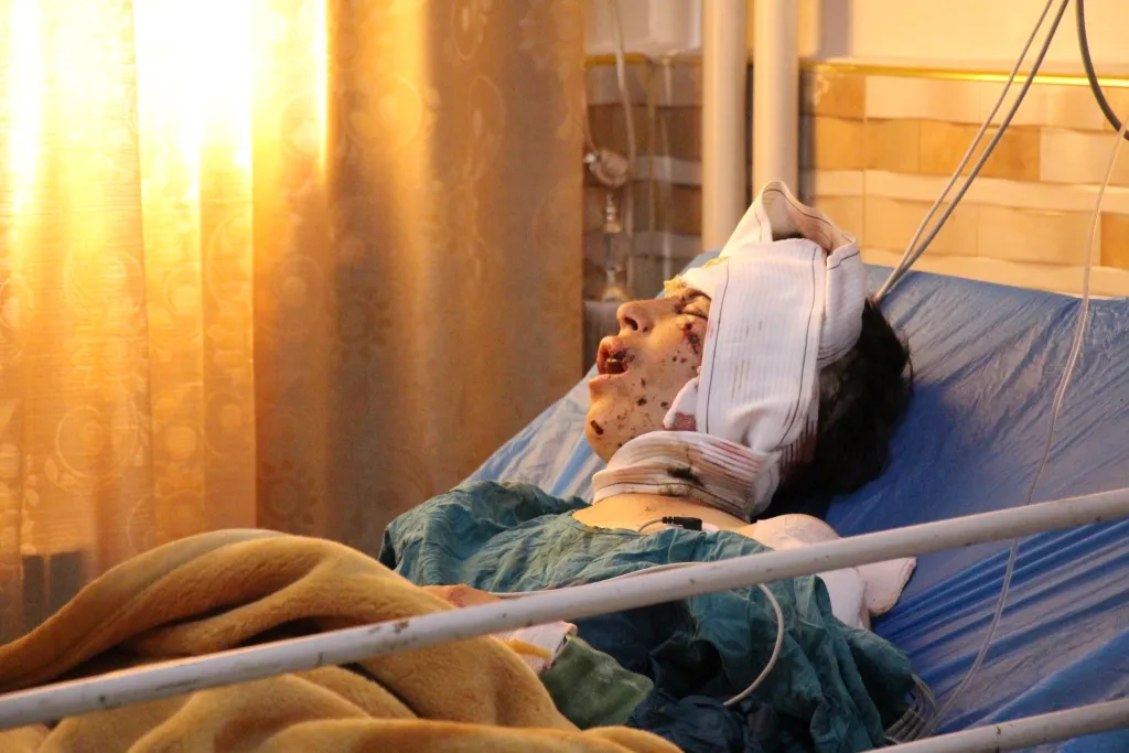 Birîndarên komkujiya Qurifilê ji ANHA`yê re axivîn