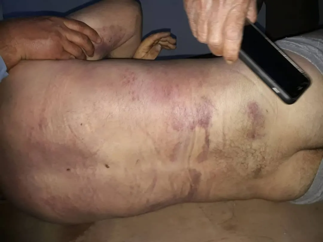 Ji Efrîn heta Girê Spî; Mafên mirovan tê binpêkirin