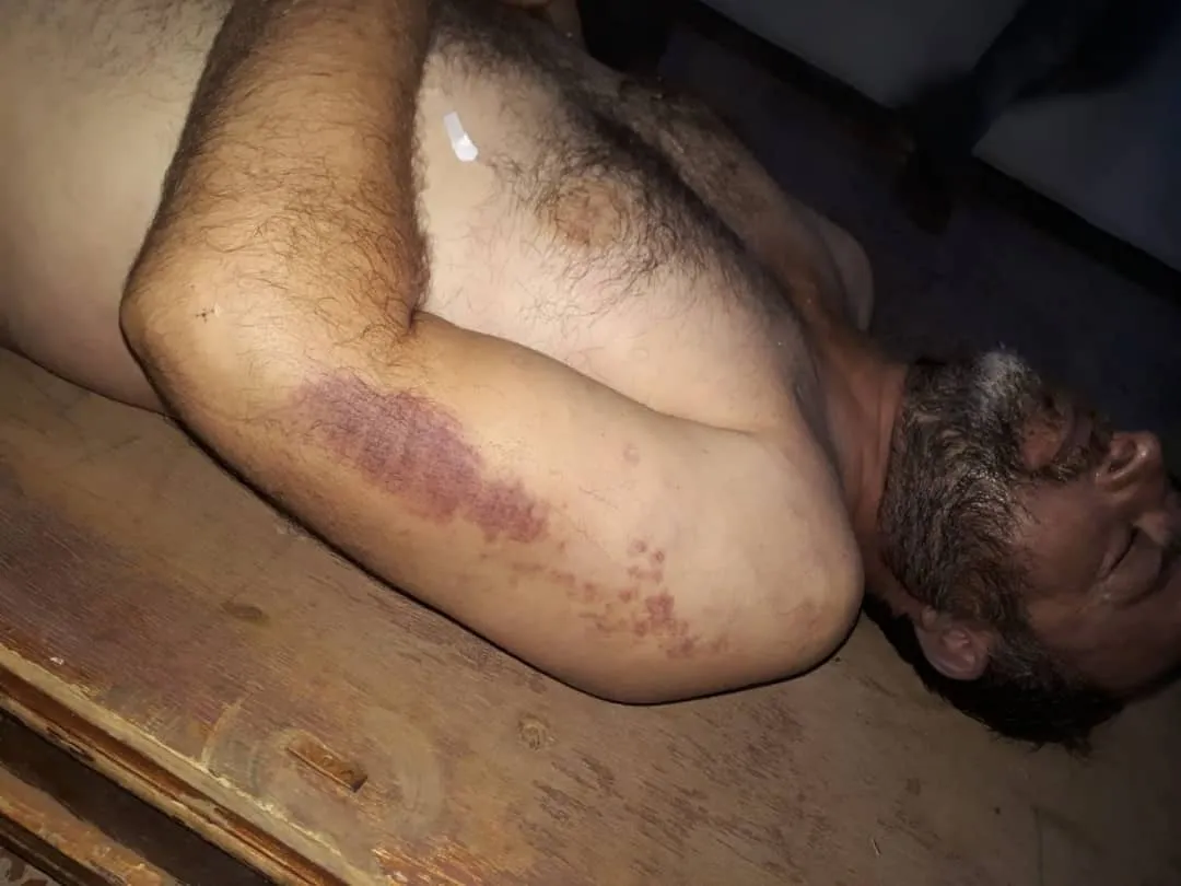 Ji Efrîn heta Girê Spî; Mafên mirovan tê binpêkirin
