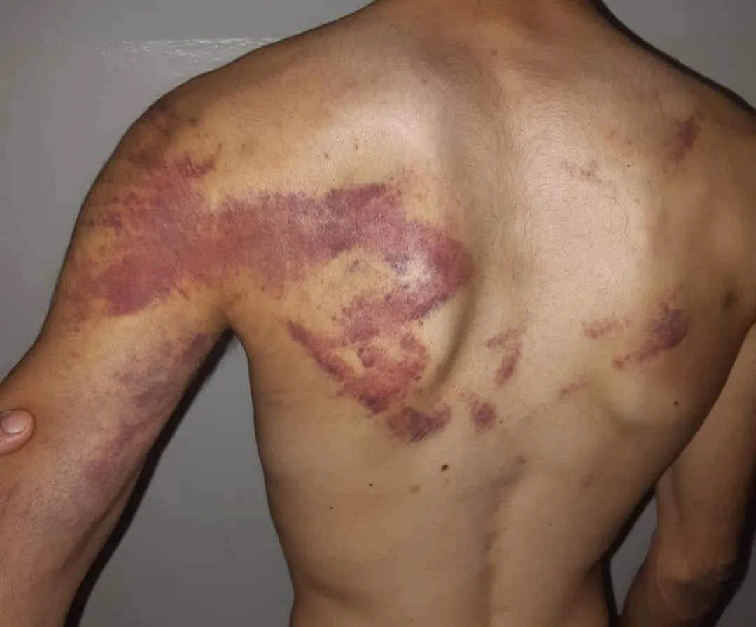 Artêşa Tirk a dagirker û çeteyên wê li Serêkaniyê ciwanek girtin û ew êşkence kirin