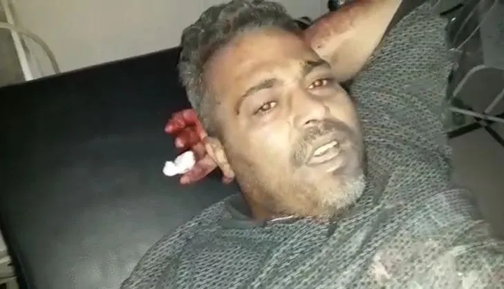 Li Eyn Îsa mayineke çeteyan teqiya: Sivîlek birîndar bû