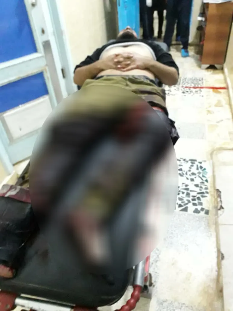 Li Til Rifetê topbarana artêşa Tirk şehîd û birîndar hene -HATE NÛKIRIN