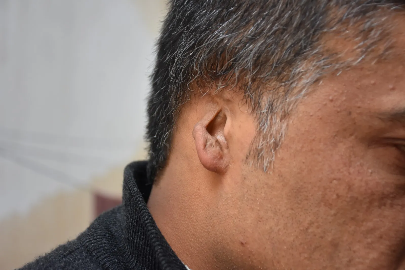 Birîndarên sivîl şahidên êrişên dewleta Tirk û çeteyan in