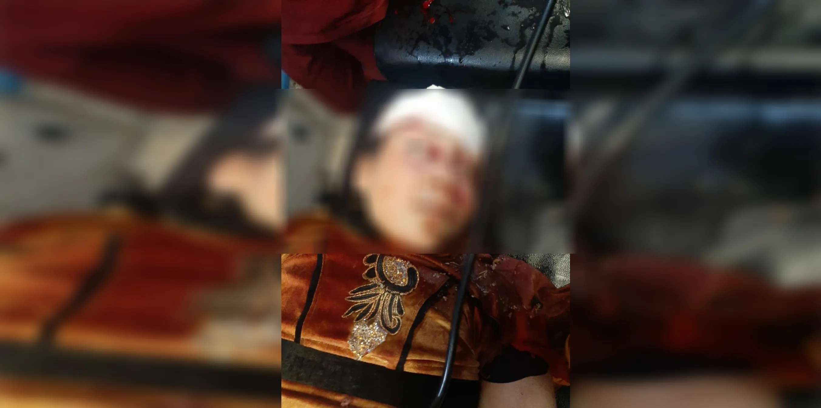 Sivîleke ku di topbaran dagirkeriya Tirk de birîndar bûbû, jiyana xwe ji dest da