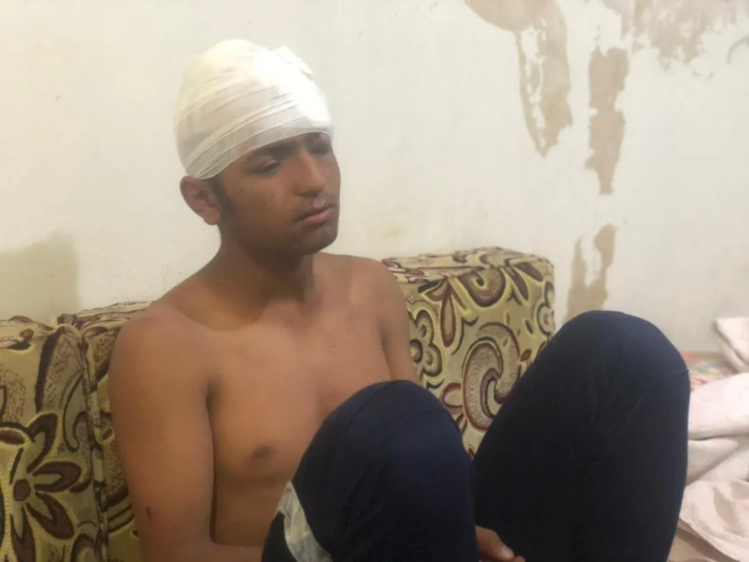 ​​​​​​​Leşkerên Tirk li nêzî sînor li zarokekî Kobanê da