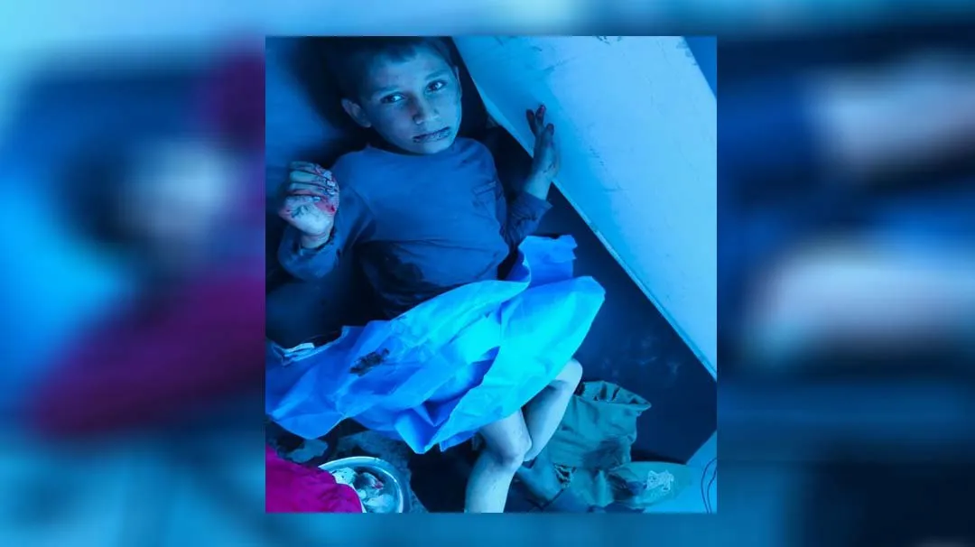 Artêşa Tirk topbarana li ser Eyn Îsayê zêde kirine