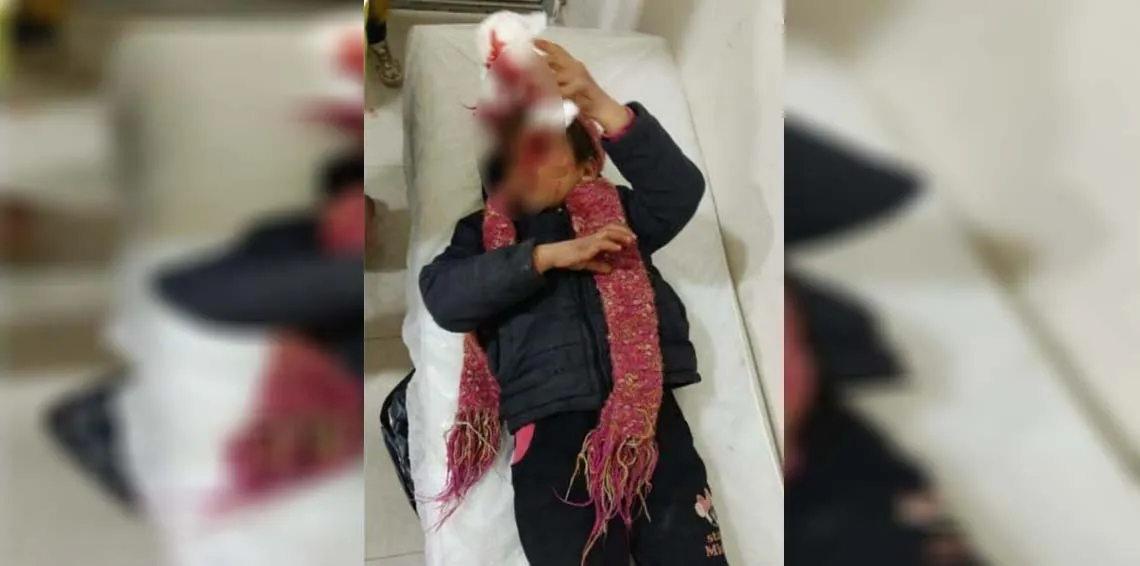 ​​​​​​​Çeteyên dewleta Tirk li Efrînê 10 zarok birîndar kirin