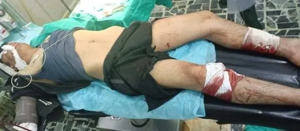 Li gundê Aqîbê yê Şêrawa ciwanek bi mayinekê birîndar bû