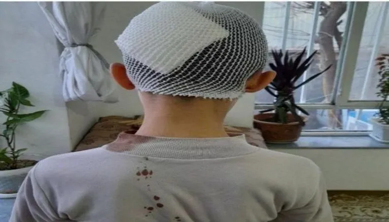 Li Kabulê teqîn; herî kêm 6 kes birîndar bûn