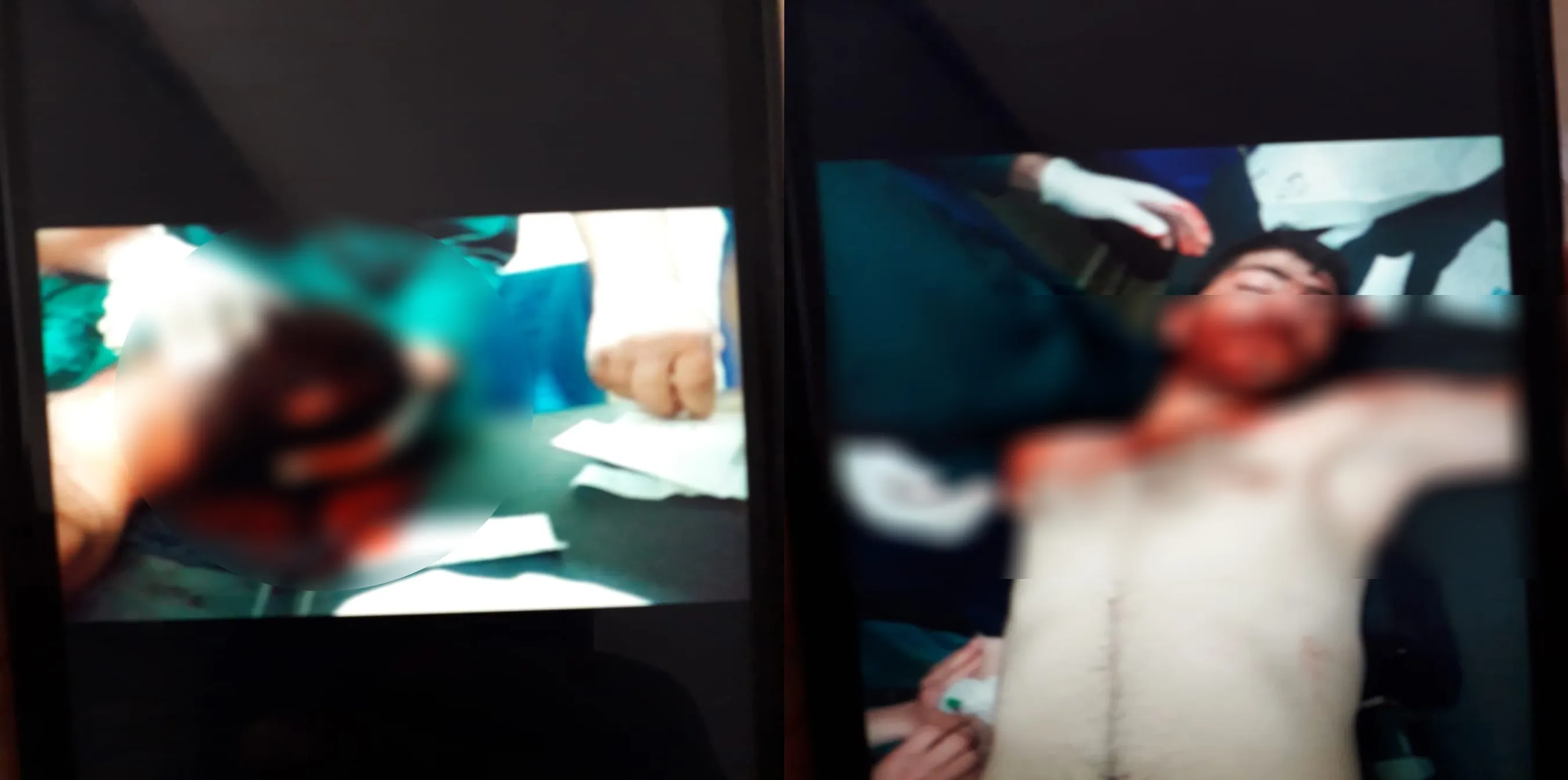 Topbarana li ser Şehbayê berdewam e; 2 leşkerên hikumeta Şamê birîndar bûn