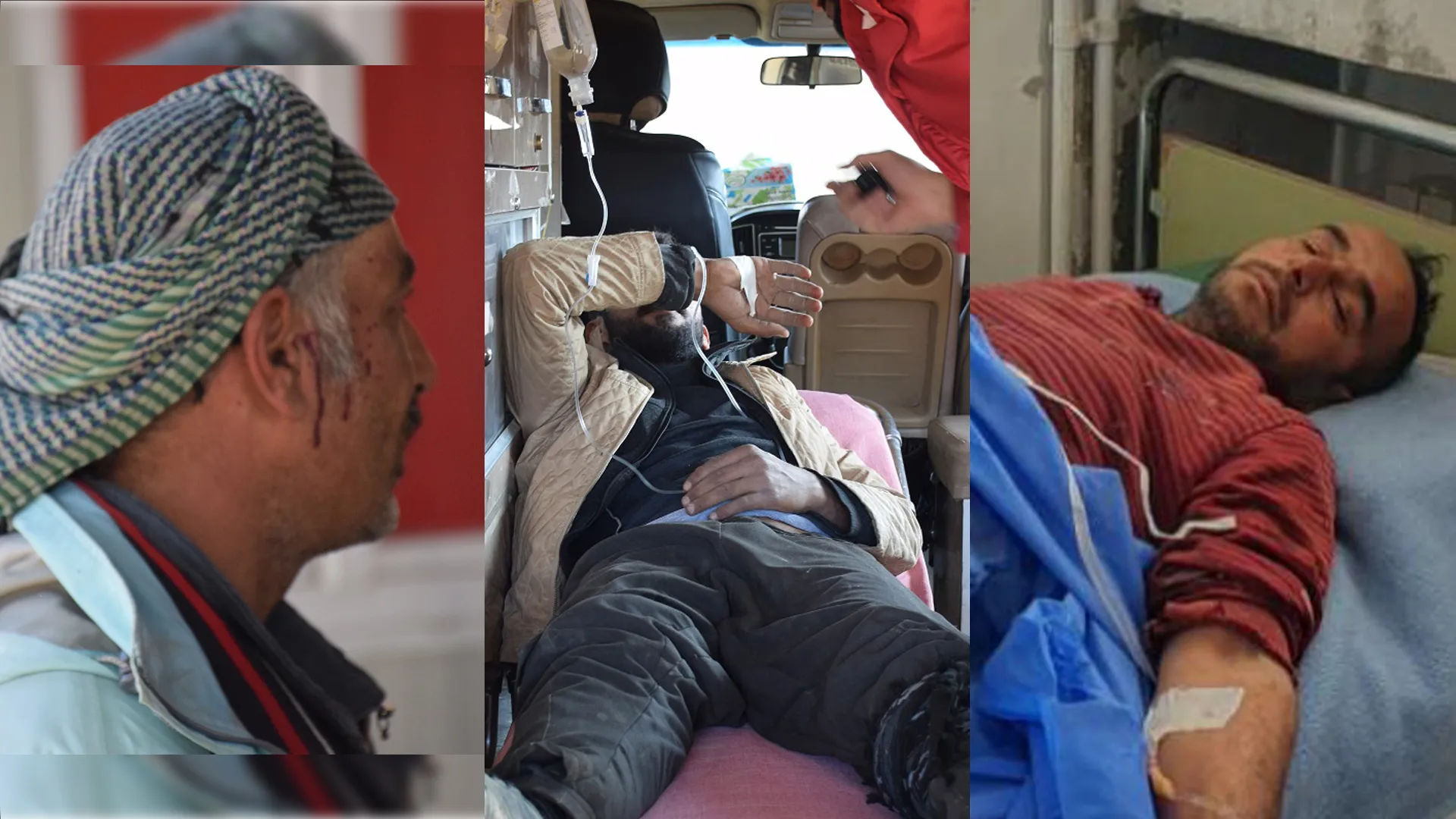 14 birindarên bombebaranê veguhestin nexweşxaneyan