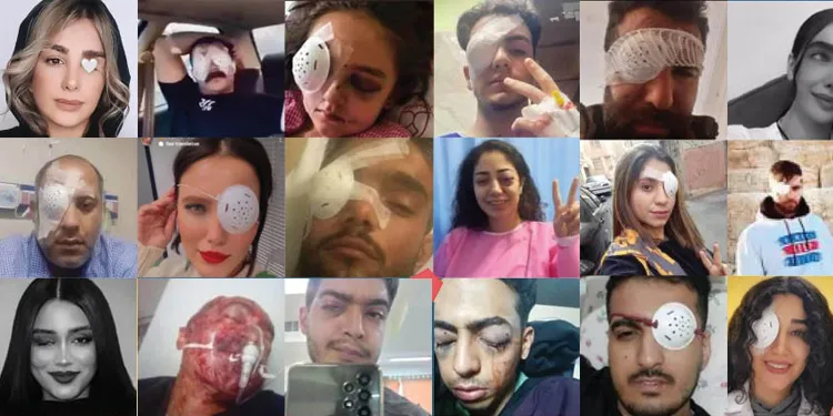 ʹJi ber êrişên dewleta Îranê 22 kesan çavê xwe ji dest daneʹ