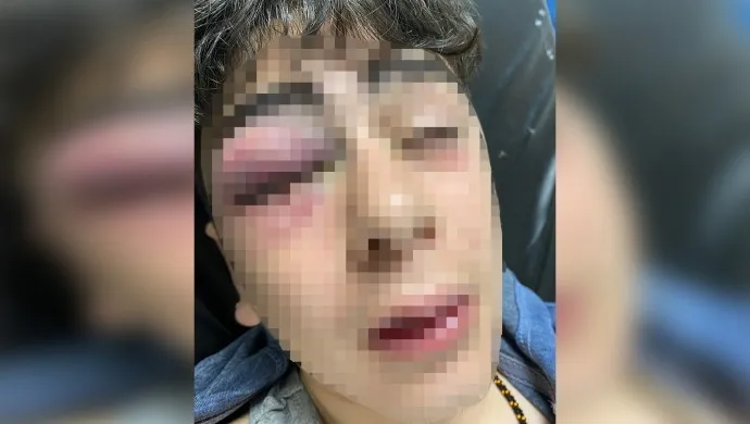 Polîsan Tirk îşkence li zarokekî Kurd kir û jê xwest bibêje ‘ez Tirk im’