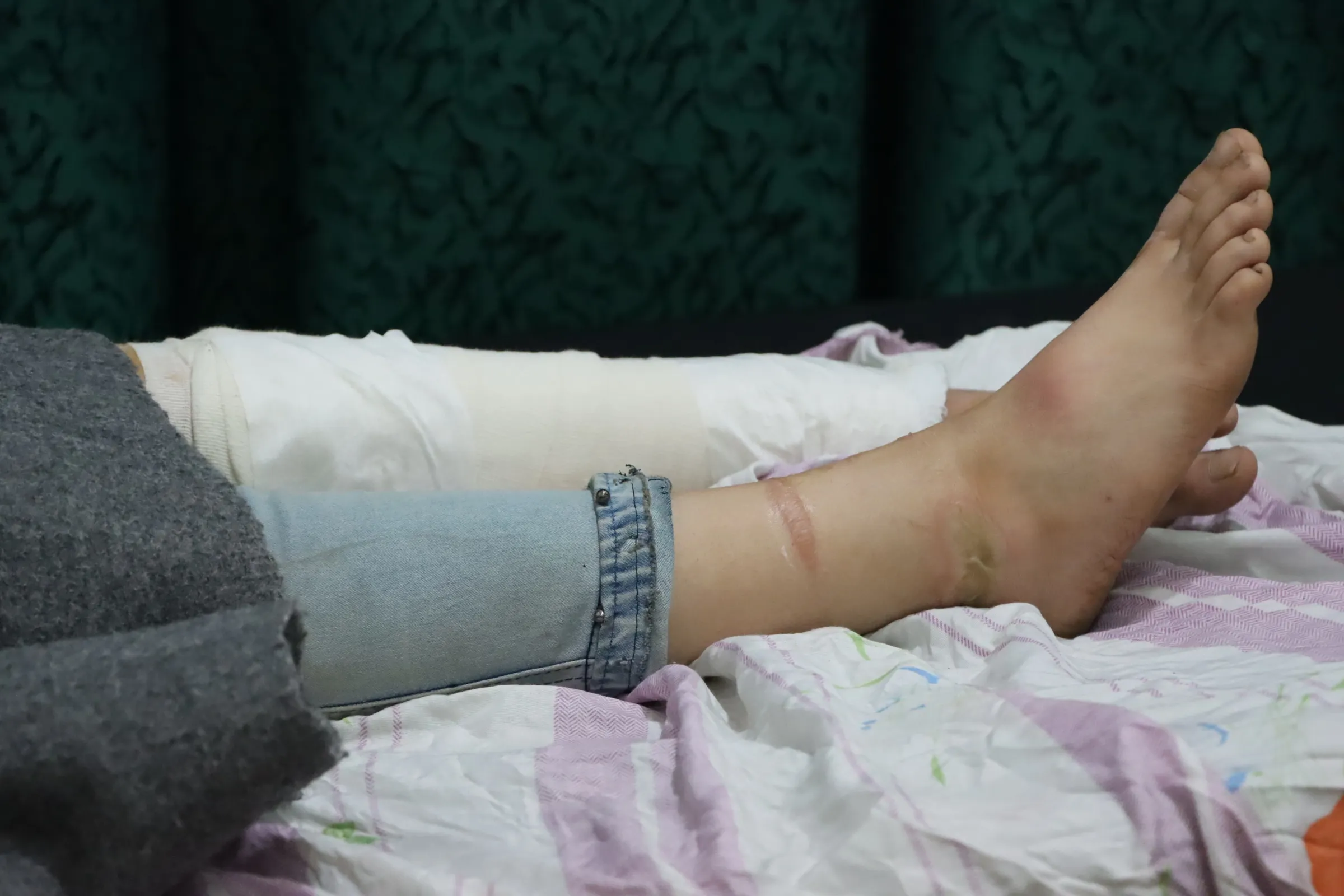 Li Qamişloyê kargeha tenerê şewitî, 3 karker birîndar bûn