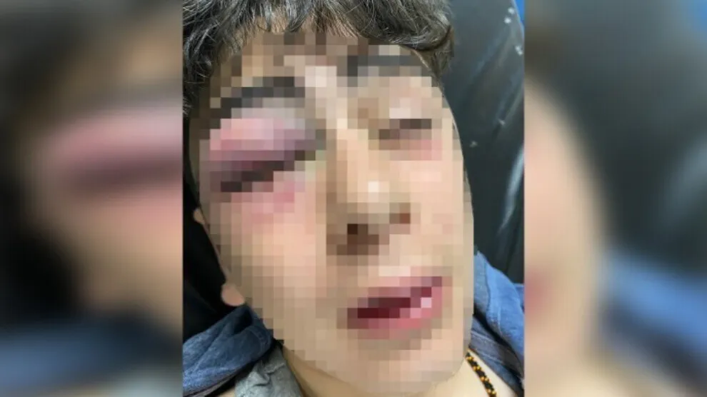 Zarokê Kurd ku polîsan êşkence lê kir 3 êşkencekar teşhîs kirin