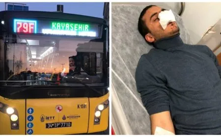 Li Tirkiyeyê nîjadperestiya li dijî geştiyar û penaberan zêdetir dibe