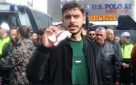 ‘Guleya plastîkê serê min ket’