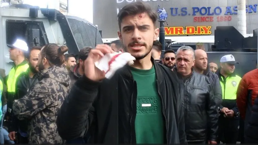‘Guleya plastîkê serê min ket’