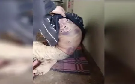 Çeteyên dewleta Tirk îşkence li astengdarekî kir