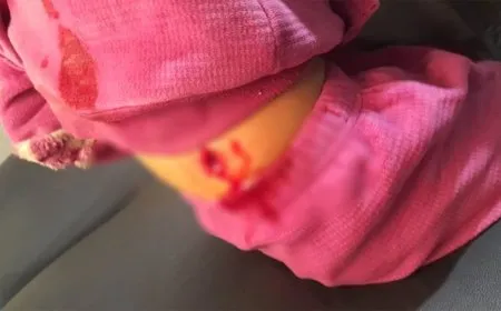 Di êrişa hêzên hikûmetê de li Dêrhafirê zarokek birîndar bû