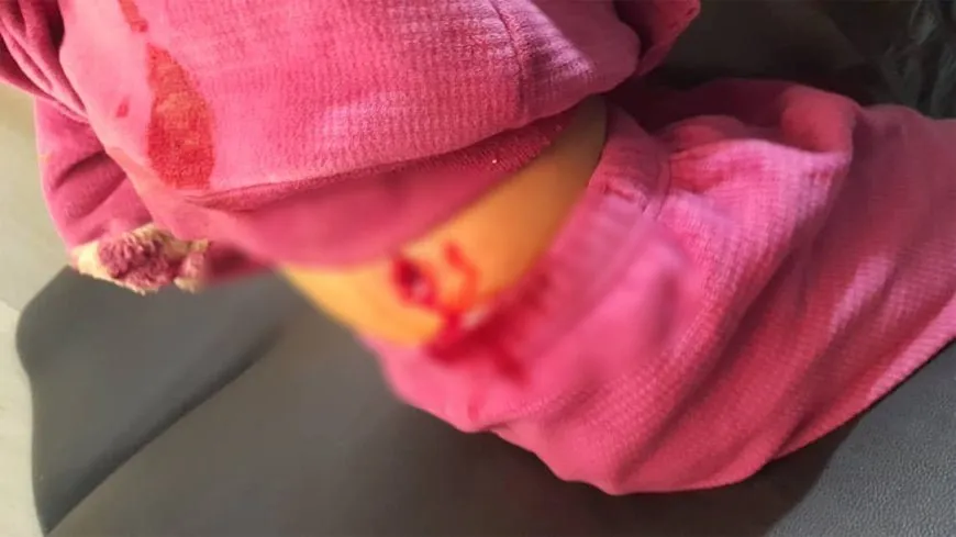 Di êrişa hêzên hikûmetê de li Dêrhafirê zarokek birîndar bû