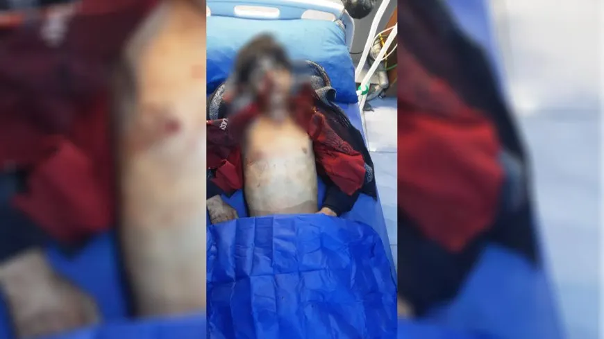 Di êrişên li dijî taxên Şêxmeqsûd, Eşrefiyê û Benî Zêd de zarokek şehîd bû