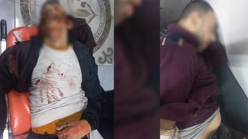 Bîlançoya êrişên li ser Helebê: 8 şehîd, 55 birîndar