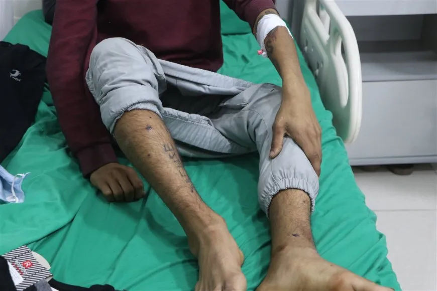 35 birîndarên berxwedana Şêxmeqsûd û Eşrefiyê gihîştin Hesekê