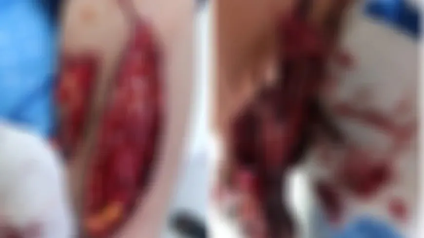 Li Qamişlo şêrekî zarokek gez kir