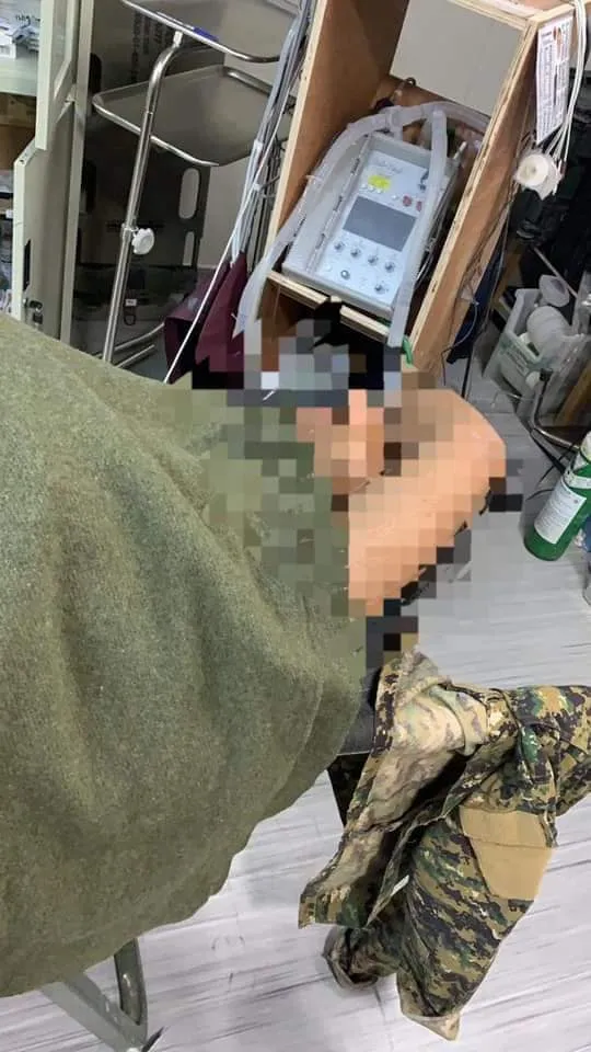 5 бойцов QSD получили ожоговые ранения при тушении пожаров