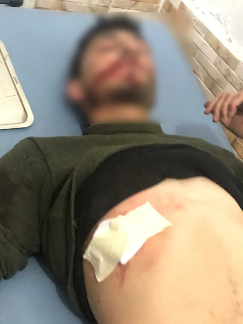Двое сирийских военных погибли при обстреле Тель-Тамера