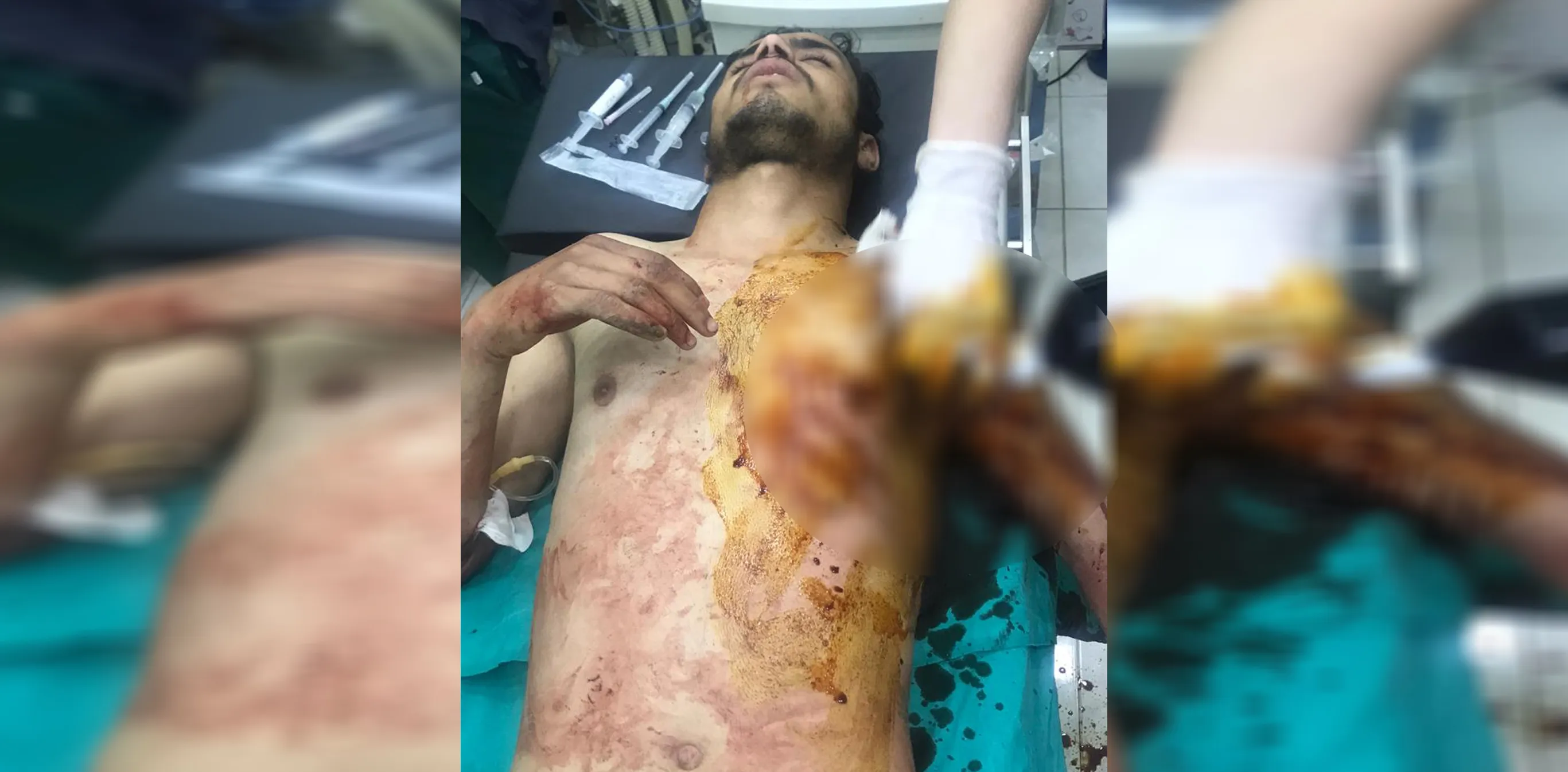 4 человека получили ранения при обстреле Зергана