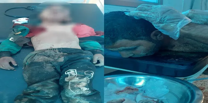 5-летний ребенок погиб при взрыве мины под Айн-Иссой