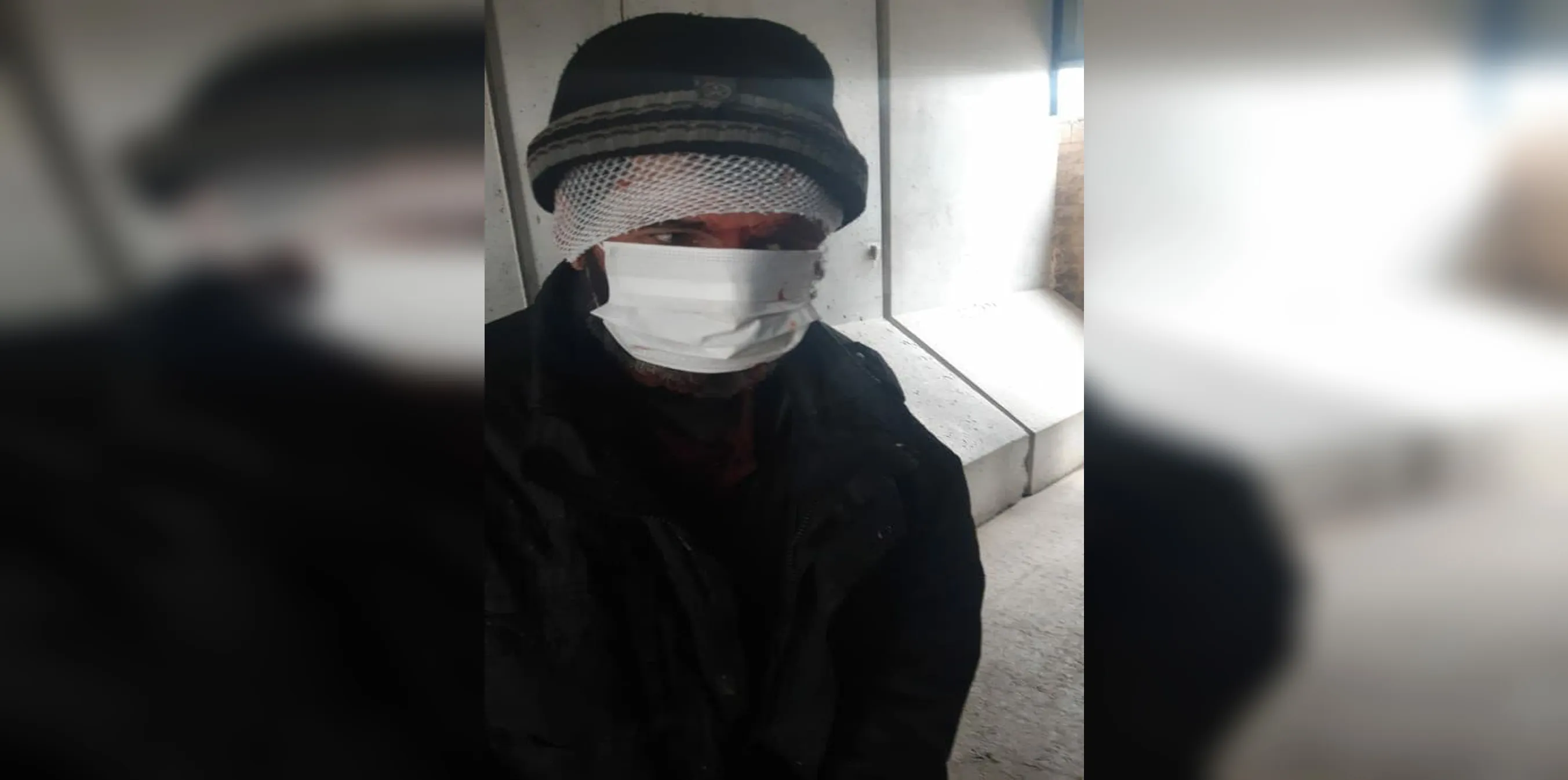 Между турецкими боевиками в Африне столкновения