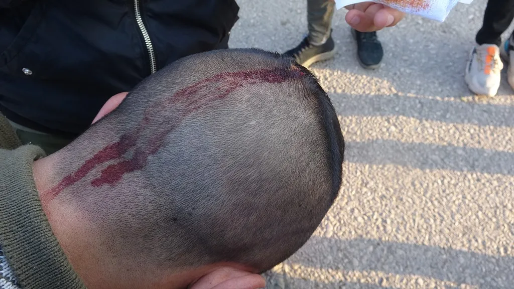 15 человек получили ранения при нападении ДПК на погранпереход Семалька