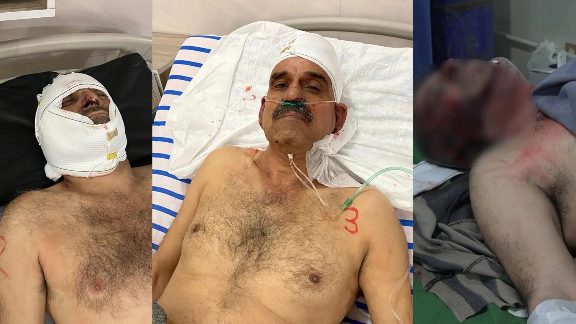 ​​​​​​​​​​​​​​3 работника в Управлении водоснабжения Кобани ранены из-за атак турецких оккупантов