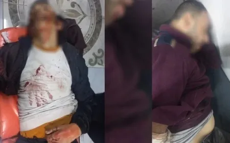 Число погибших среди мирного населения в результате продолжающихся атак в Алеппо растет